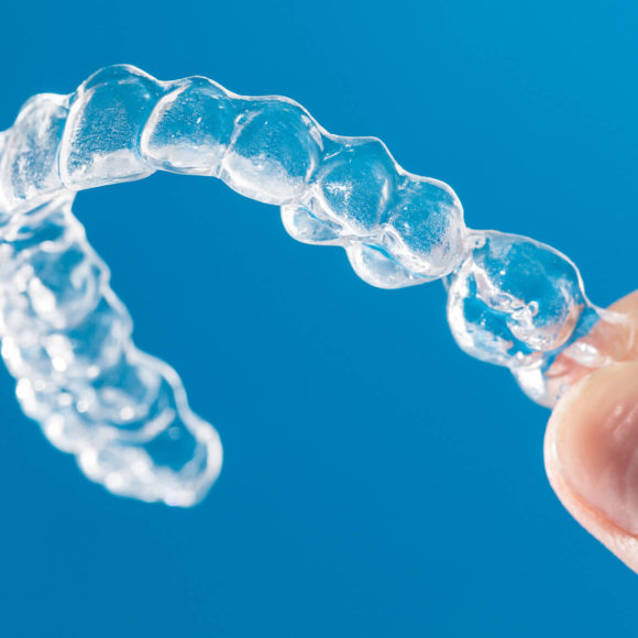 Invisalign