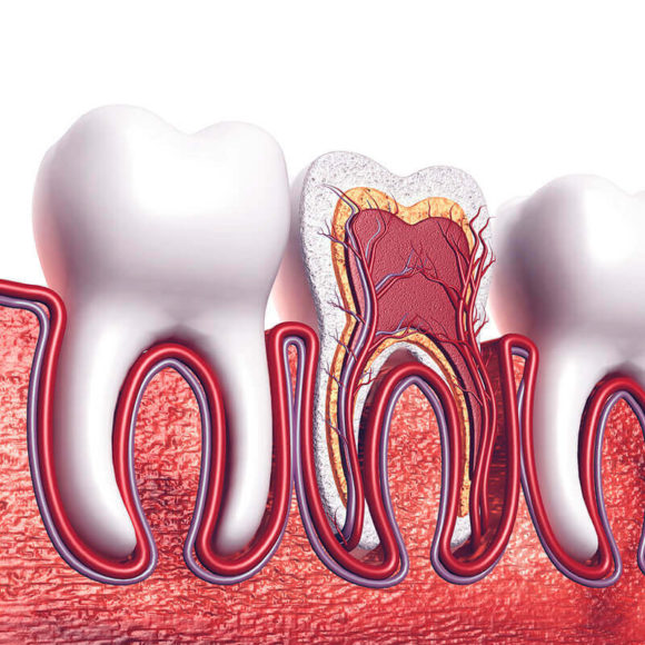 Root Canals